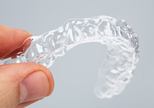 インビザライン